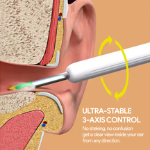 Wireless Ear Wax Removal Kit
